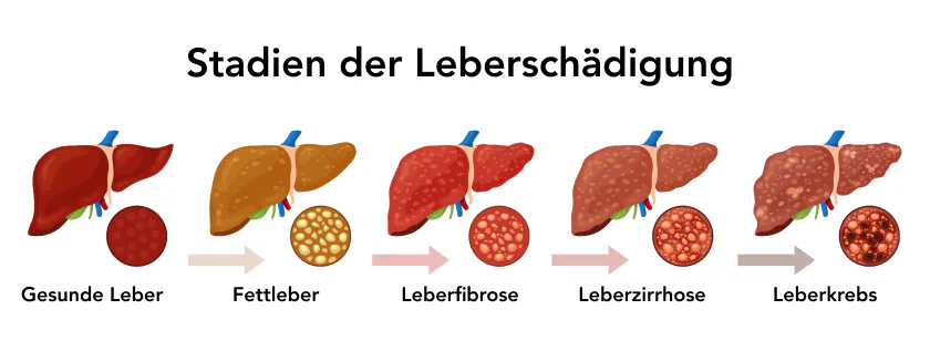 Wirkstoffe f&uuml;r die Lebergesundheit